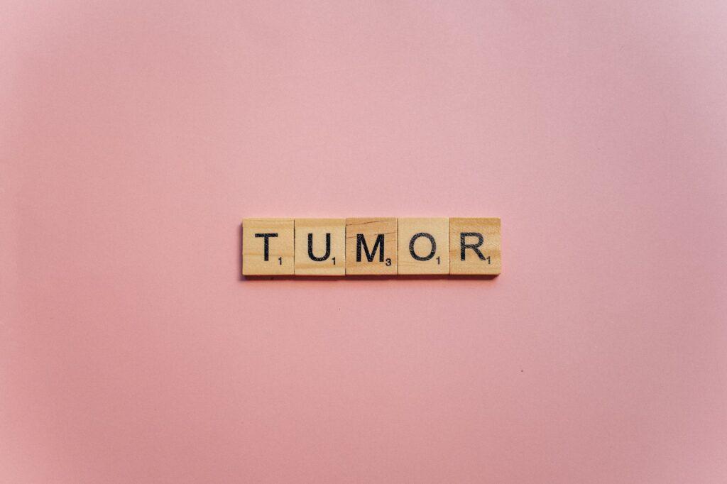 Phyllodes tumors prognosis